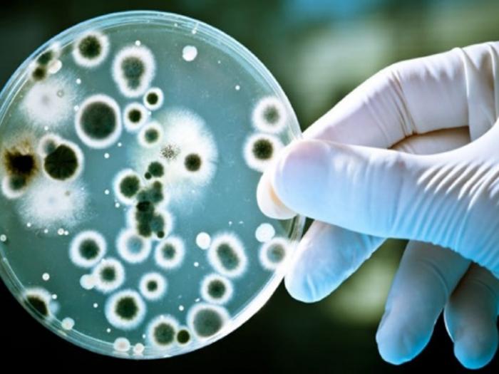 Petri Dish Mould